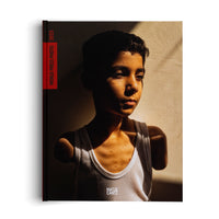 Ein Buchcover mit dem Titel World Press Photo 2025, das das Porträt eines Jungen mit amputierten Armen in einem weißen Unterhemd zeigt. Sein Gesicht wird von starkem Seitenlicht beleuchtet, das tiefe Schatten wirft, und sein Blick ist nachdenklich zur Seite gerichtet.